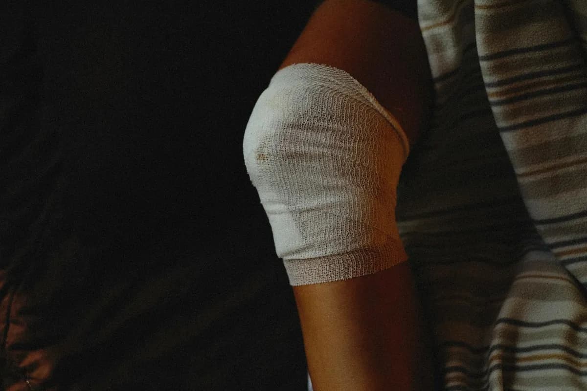 Swelling — health symptom