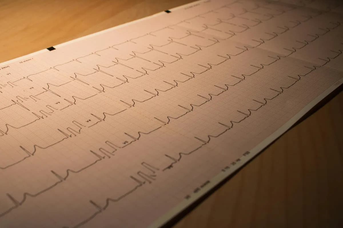 Atrial Fibrillation — health condition