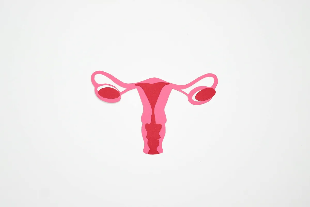 Endometriosis — health condition